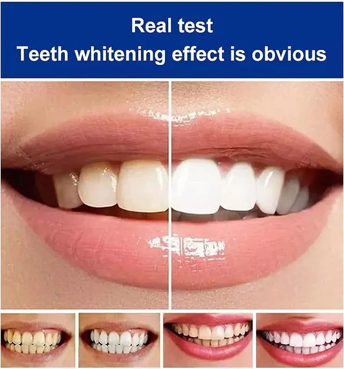 Sp-4 Probiotic Toothpaste - All Smiles Brightening & Stain Removing Toothpaste, Fresh Breath, Natural Tooth Whitening Agent (Pack of 2)