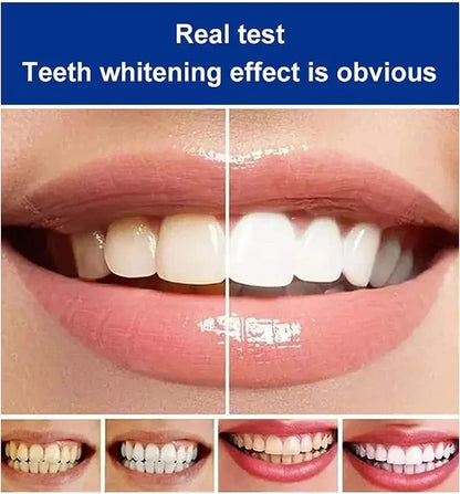 Sp-4 Probiotic Toothpaste - All Smiles Brightening & Stain Removing Toothpaste, Fresh Breath, Natural Tooth Whitening Agent (Pack of 2)