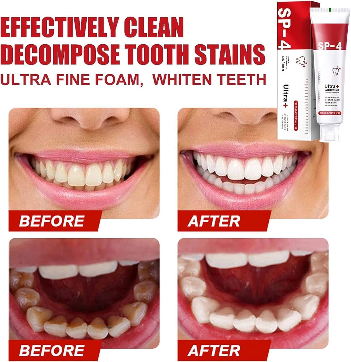 Sp-4 Probiotic Toothpaste - All Smiles Brightening & Stain Removing Toothpaste, Fresh Breath, Natural Tooth Whitening Agent (Pack of 2)